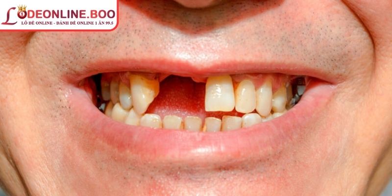 Người chơi nên chọn cặp 24 hoặc 42 khi mộng ra hàm vỡ 