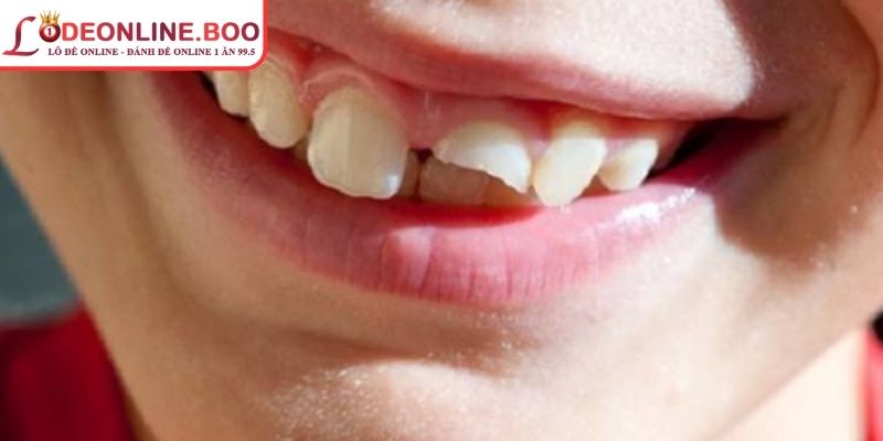 Phân tích chi tiết giấc mộng về miệng và cầu cược